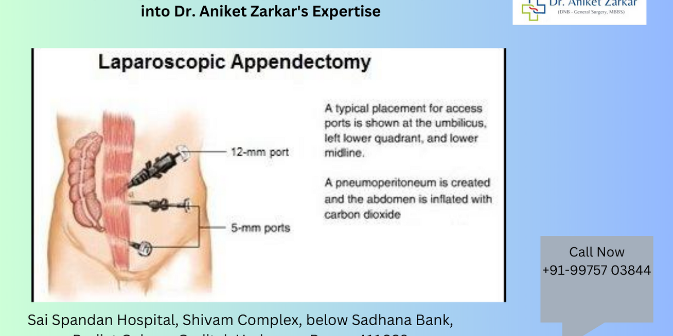 Exploring Laparoscopic Appendectomy: A Glimpse into Dr. Aniket Zarkar’s Expertise Gallbladder Treatment in Hadapsar