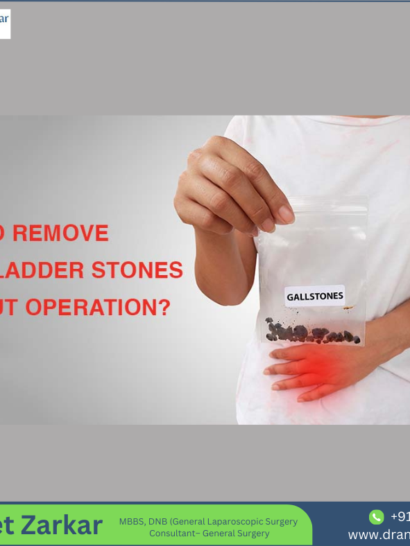 Gallbladder Treatment in hadapsar