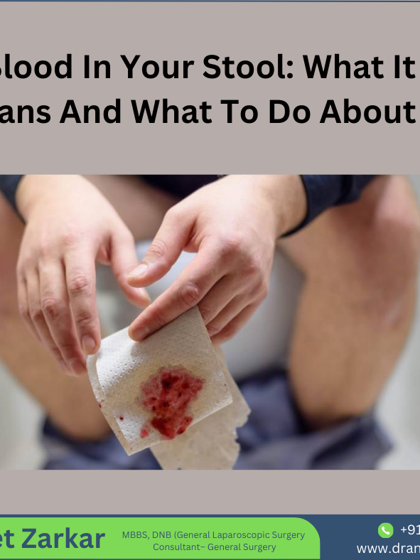 Piles specialist in hadapsar