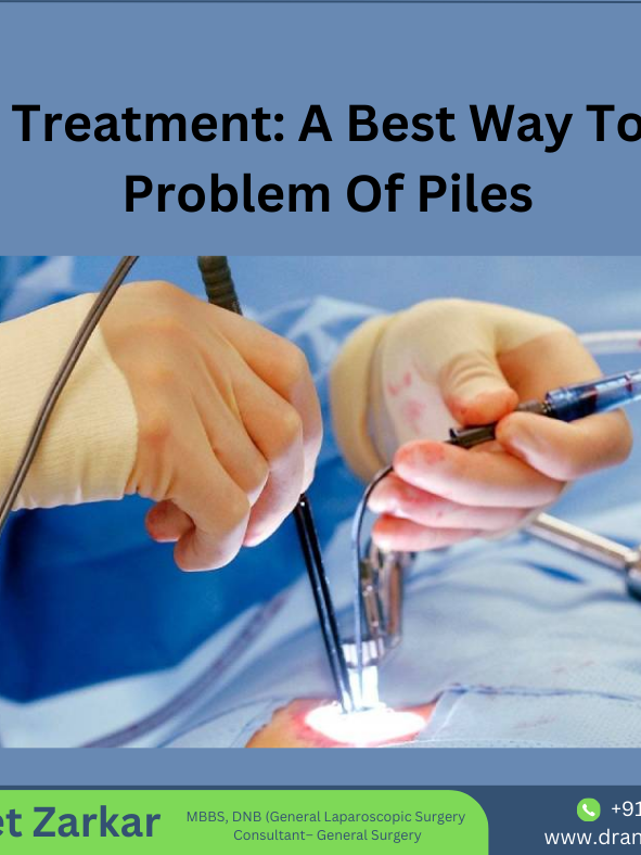 Piles specialist in hadapsar