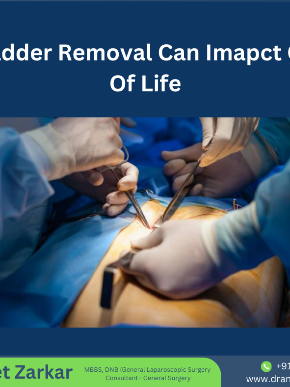 Gallbladder Treatment in hadapsar