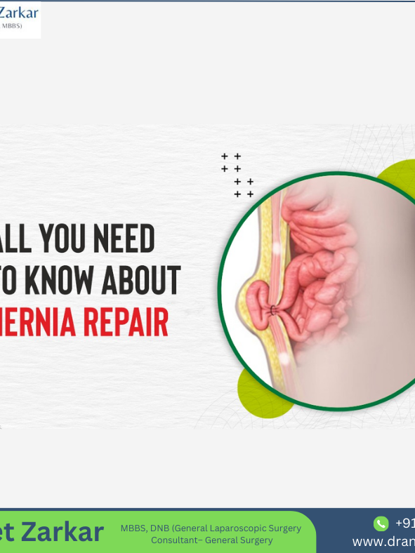 Hernia treatment in hadapsar