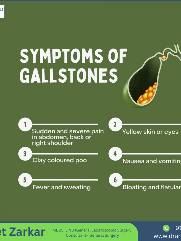 Understanding Gallstones: Symptoms and Insights from Dr. Aniket Zarkar Gallstones