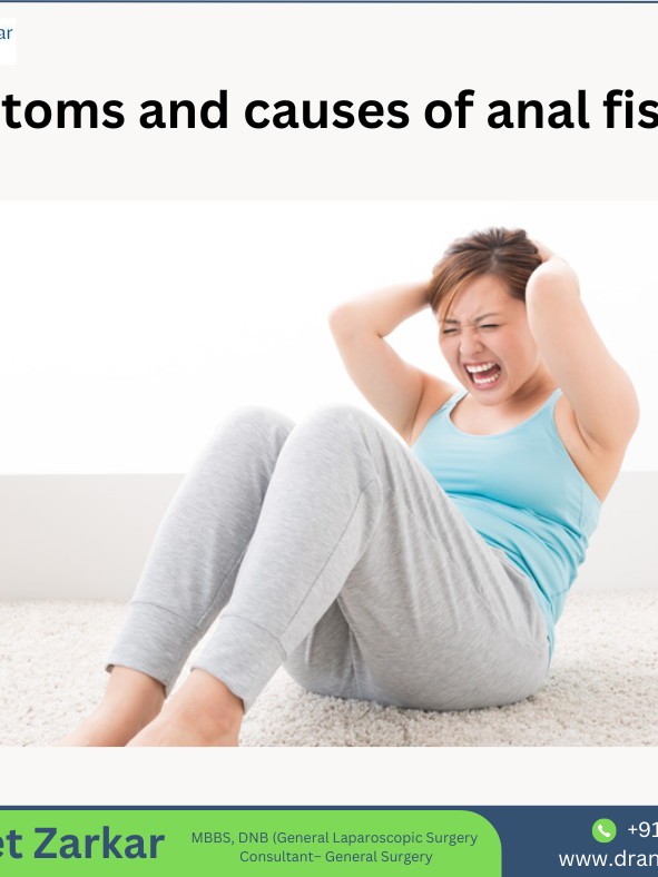 Symptoms and causes of anal fissures fissures