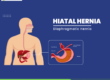 Hernia Treatment in Hadapsar