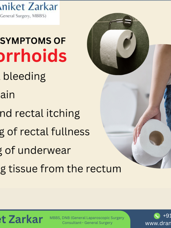 Understanding Hemorrhoids: Symptoms and Treatment Options in Pune Hemorrhoids: Treatment Options in Pune