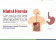 Hiatal Hernia Treatment in Pune