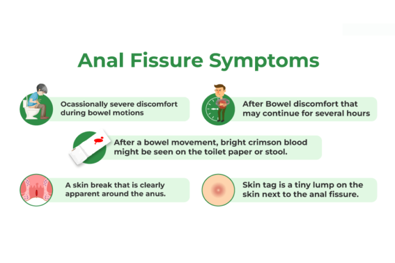 Anal Fissure Treatment in Pune