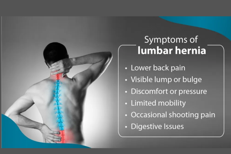 Lumbar Hernia treatment in Pune